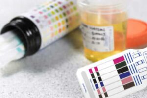 Exámenes toxicológicos para ser candidatos en Puebla pide el PRI