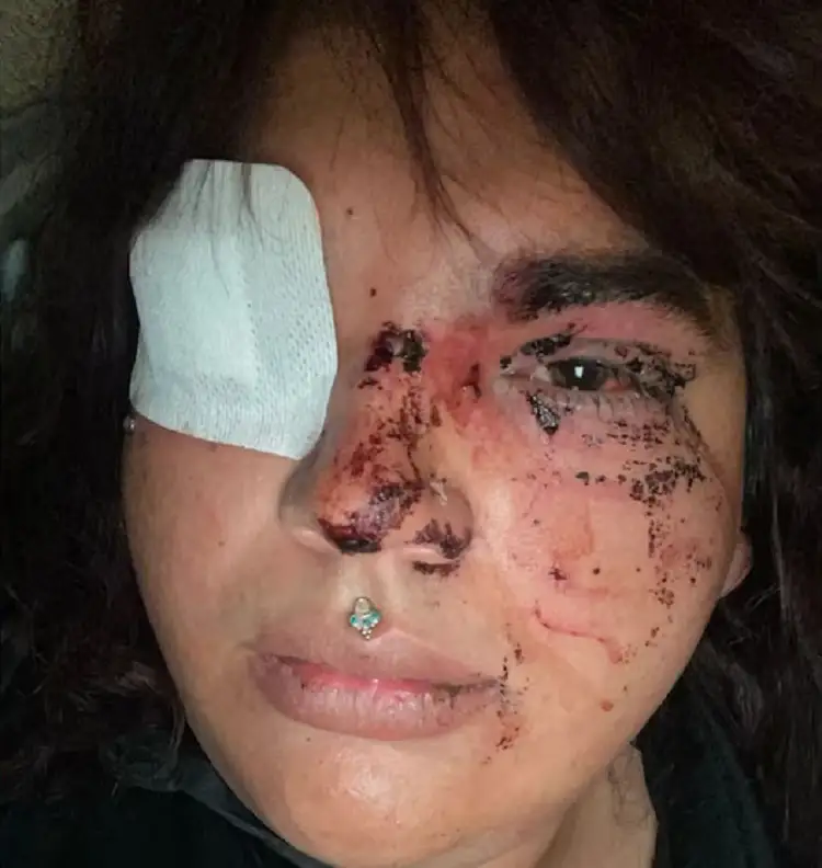 Crimen de odio en España: Agreden violentamente a Miss Trans Zamora por querer usar el baño de mujeres 2 Agreden a mujer trans en La Bañeza por querer entrar al baño