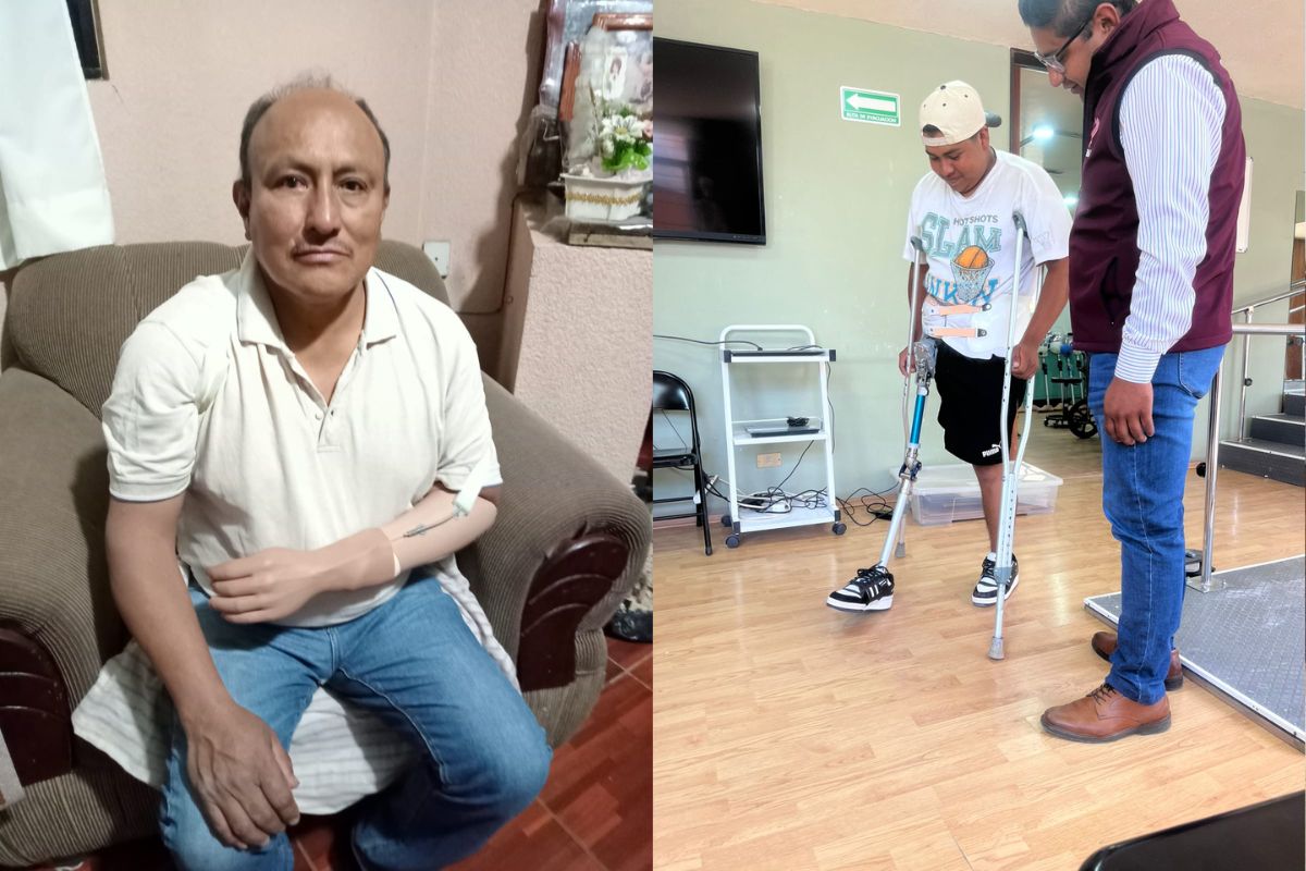 Diego y Don Ranufo reciben sus primeras prótesis tras gestión de Shamy Spezia