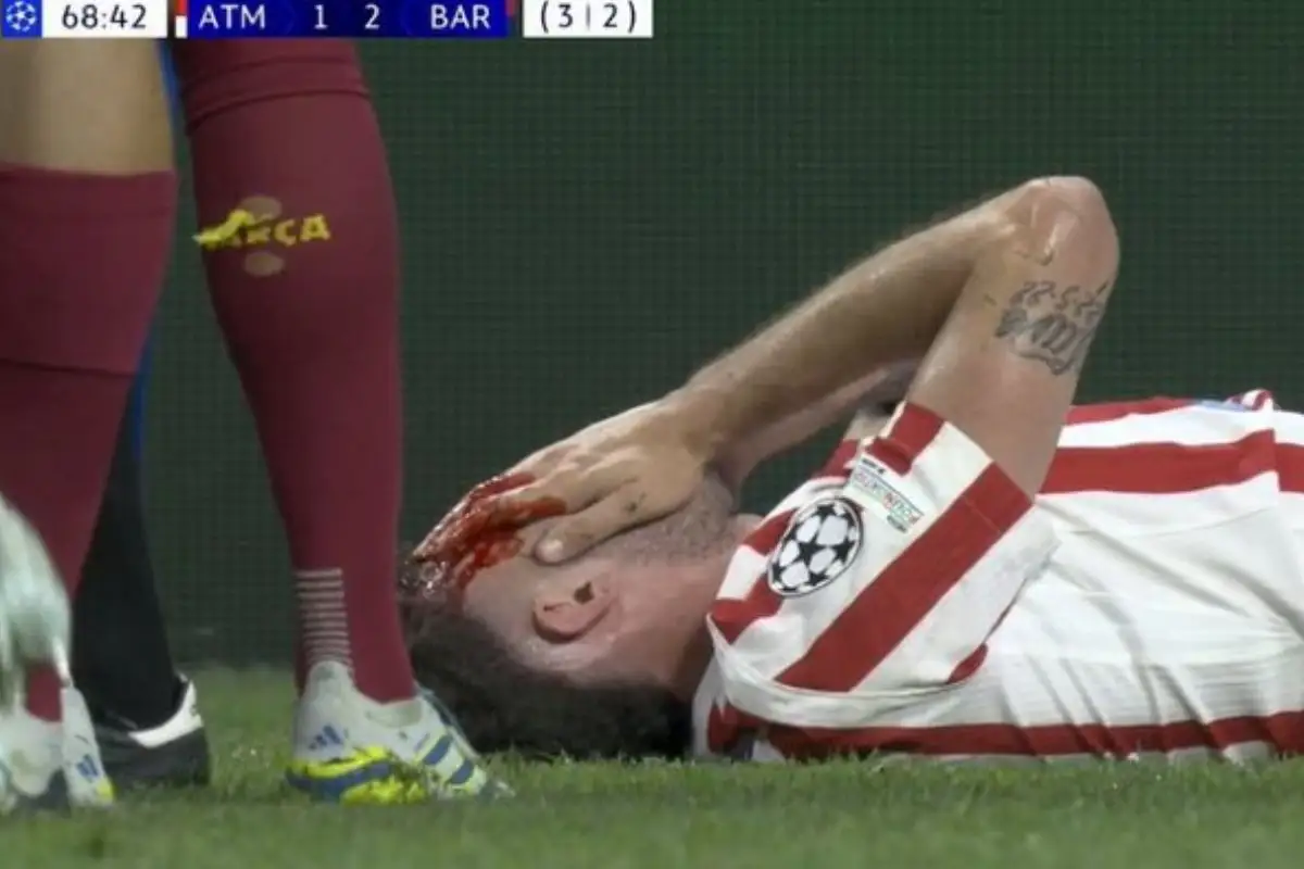 Gavi suelta codazo a Ruggeri y le saca sangre del rostro