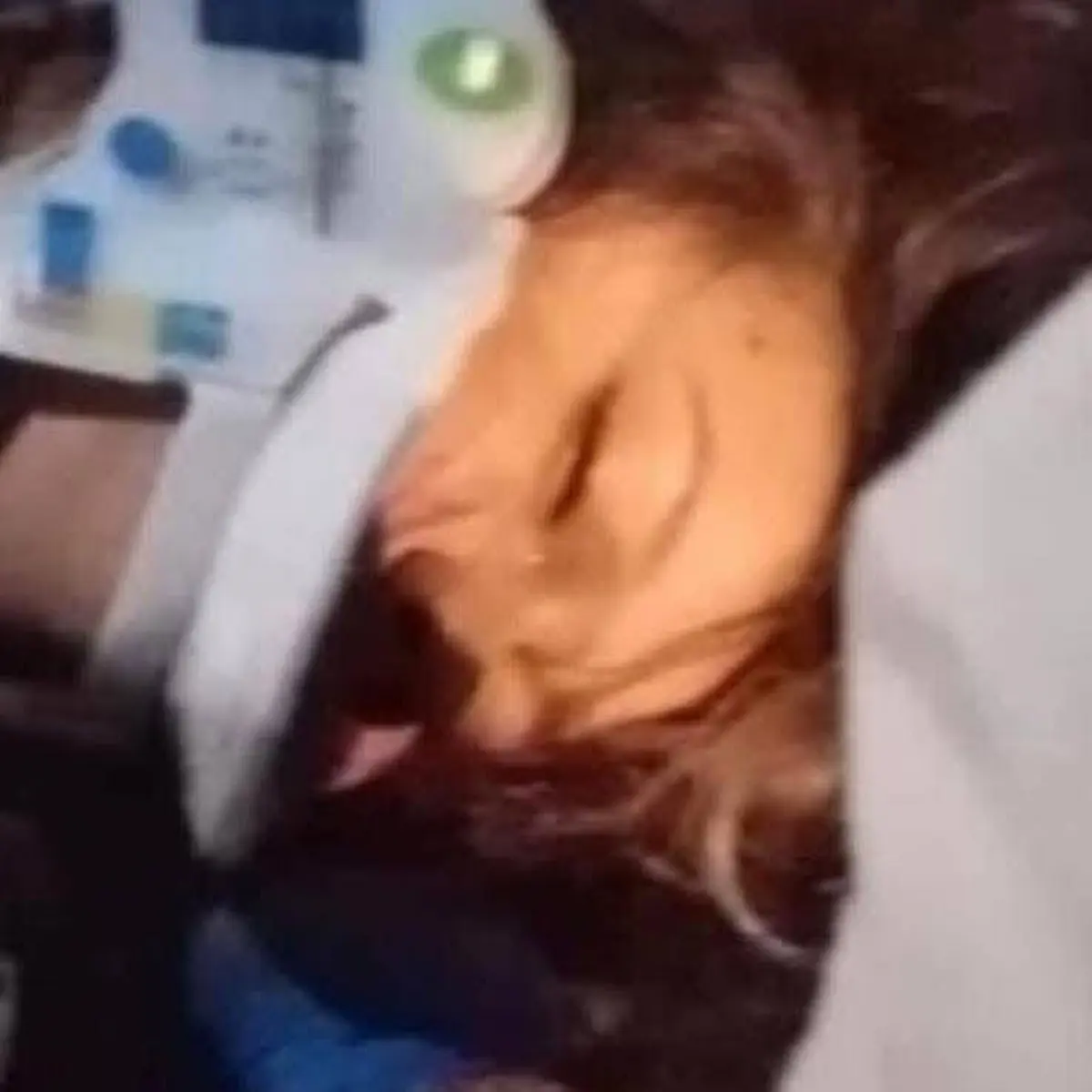 Taxista atropella a motociclista en Huauchinango