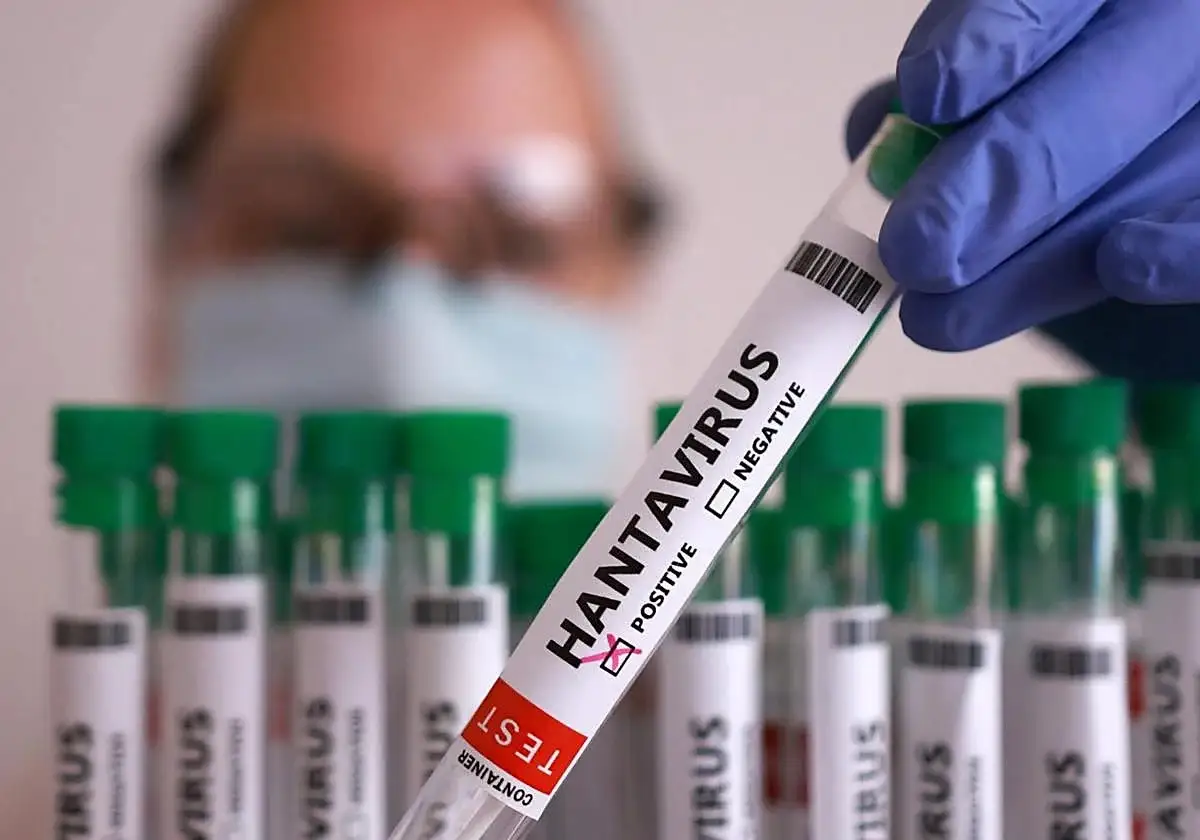 Contagios de hantavirus no desatarán otra pandemia: OMS