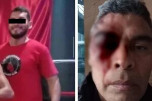Entrenador de box golpea a guardia de seguridad en Momoxpan; podría perder la vista