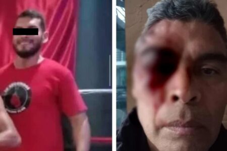 Entrenador de box golpea a guardia de seguridad en Momoxpan; podría perder la vista