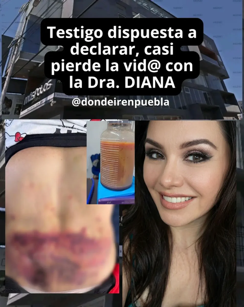 Paciente casi pierde la vida por una mini Lipo en la Clínica Detox