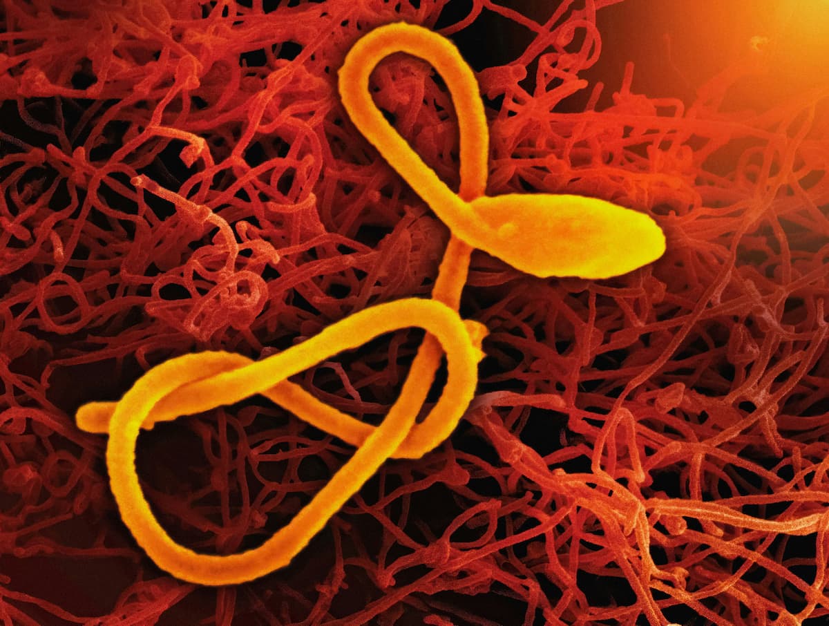 México no registra casos de ébola