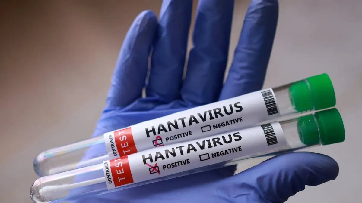 Hantavirus en España: autoridades confirman segundo caso 