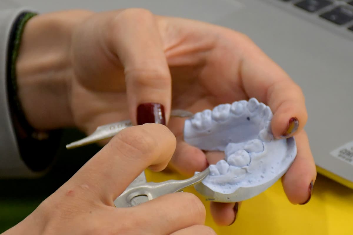 Estudiante investiga cómo fortalecer el esmalte dental para reducir caries en niños 2 estudiante BUAP esmalte dental 2
