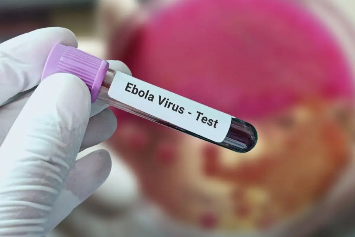 Descartan dos posibles casos de ébola en Brasil