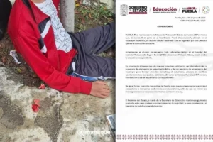 Golpean a estudiante en Atlixco y termina en el hospital