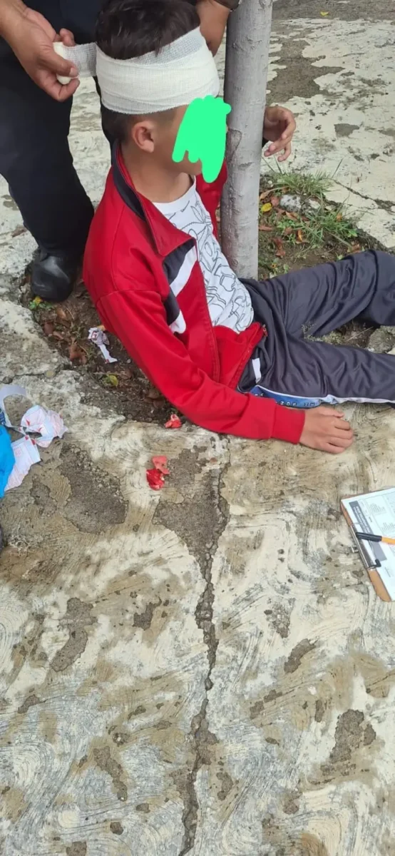 Dan brutal golpiza a estudiante de bachillerato José Vasconcelos en Atlixco; está hospitalizado 3 Golpean a estudiante en Atlixco y termina en el hospital