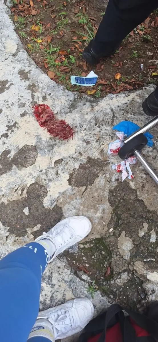 Dan brutal golpiza a estudiante de bachillerato José Vasconcelos en Atlixco; está hospitalizado 2 Golpean a estudiante en Atlixco y termina en el hospital