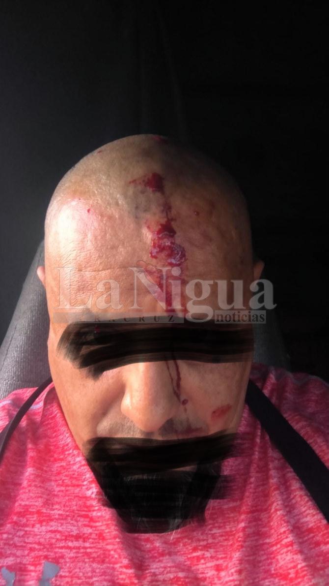 Balean a trailero durante intento de asalto en la autopista Puebla-Orizaba