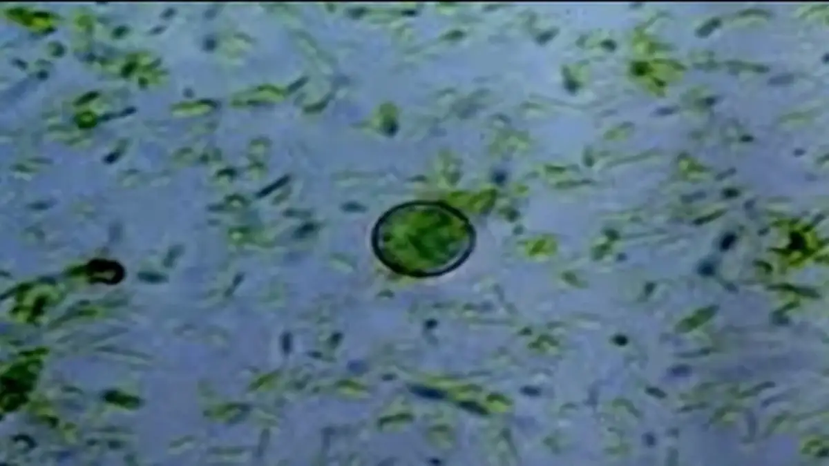 Brote de cyclospora que provoca diarrea explosiva no tuvo su origen en lechuga de México 2 SS rechaza que haya brote de cyclospora en México