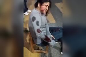 Zona de Bosques de Chapultepec donde ocurrió el ataque de perro | Foto: Cortesía