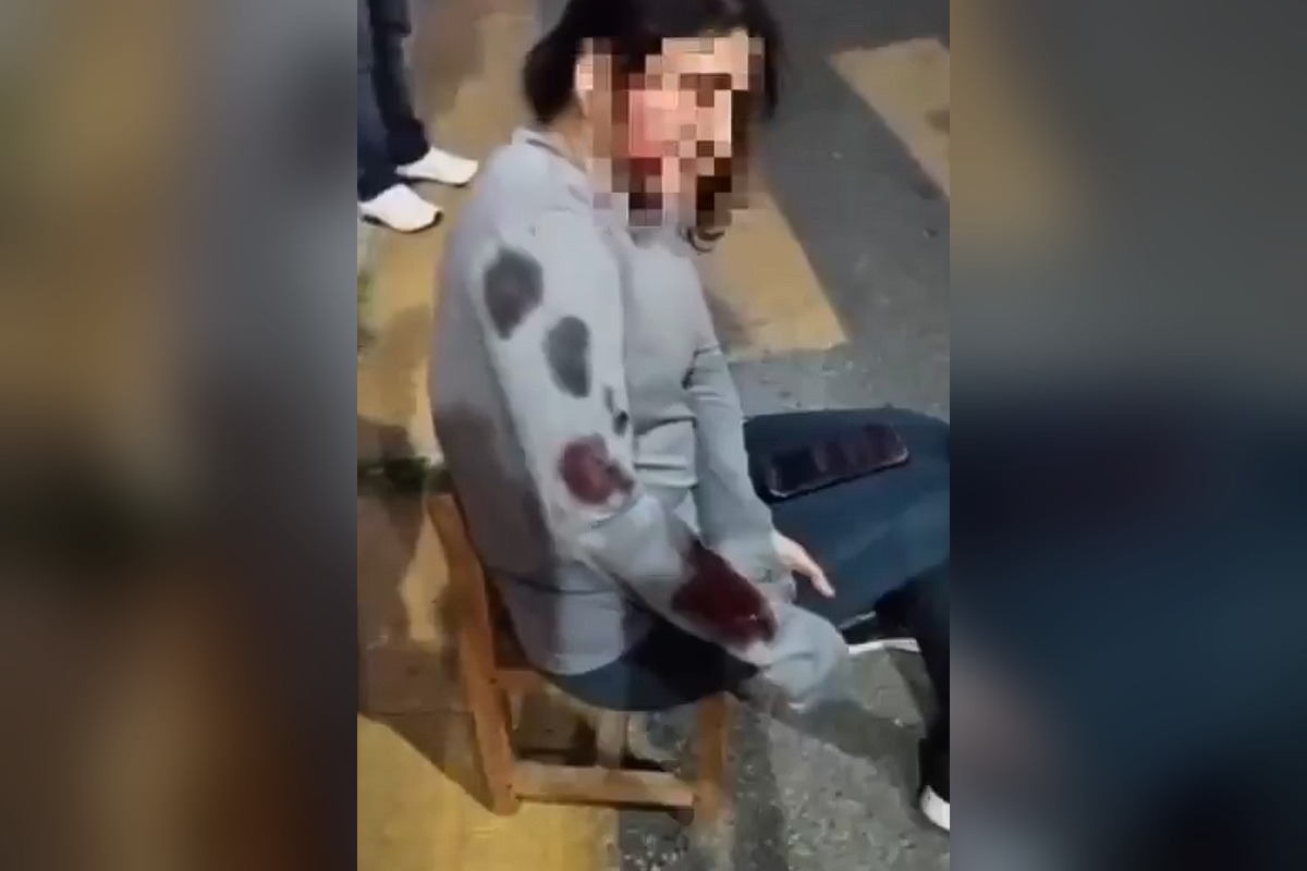 Ataque de perro en Bosques de Chapultepec deja gravemente herida a una mujer 2 Zona de Bosques de Chapultepec donde ocurrió el ataque de perro | Foto: Cortesía