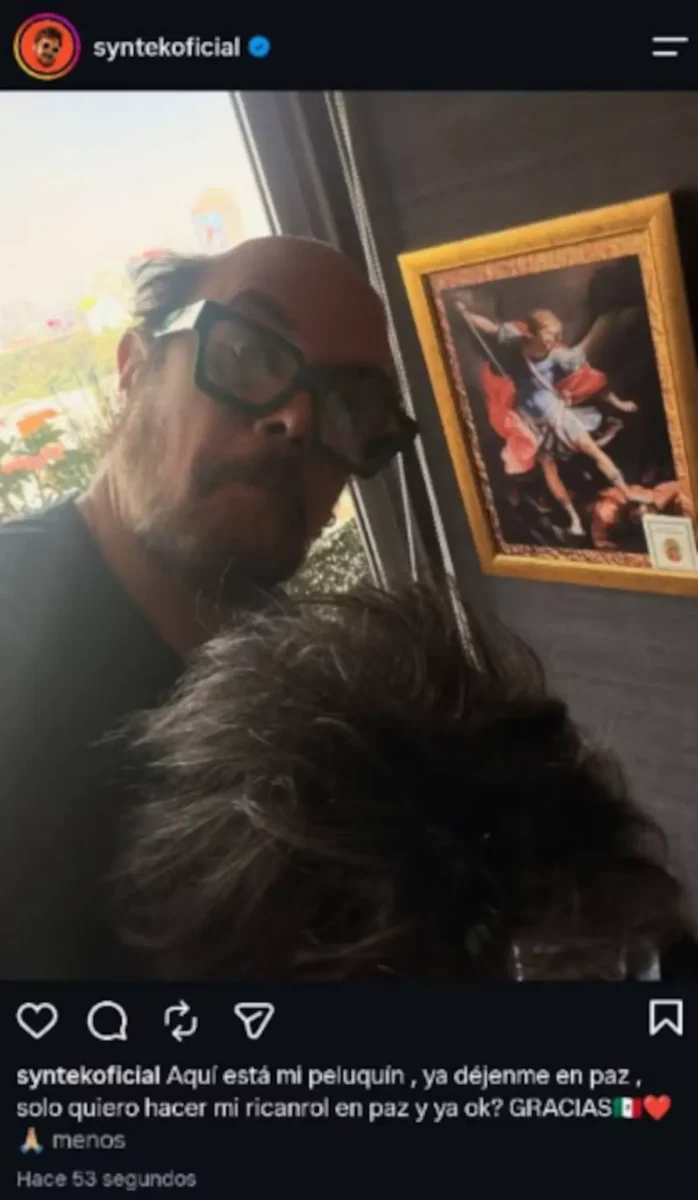 Aleks Syntek publica foto sin peluquín durante unos segundos