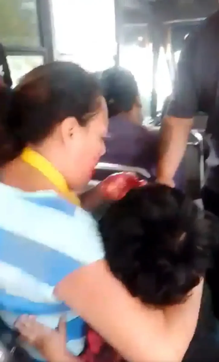 Mujer perdió dientes tras accidente de la Ruta 2A