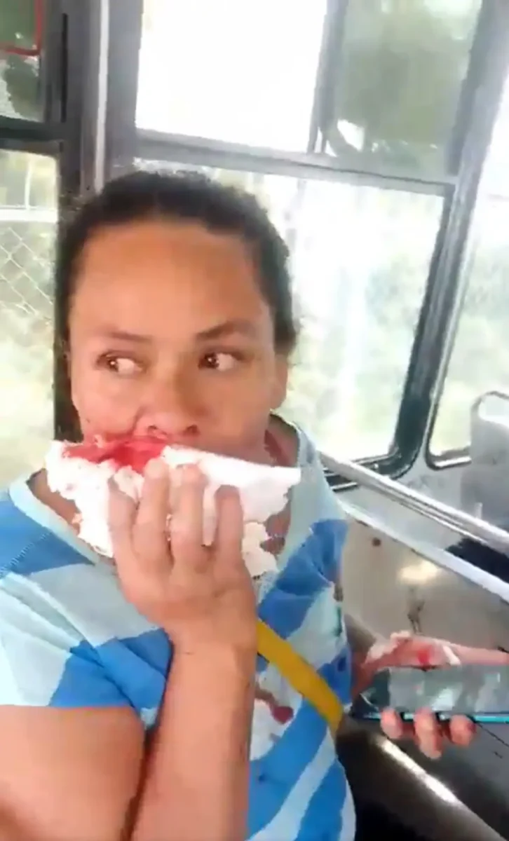 Mujer perdió dientes tras accidente de la Ruta 2A