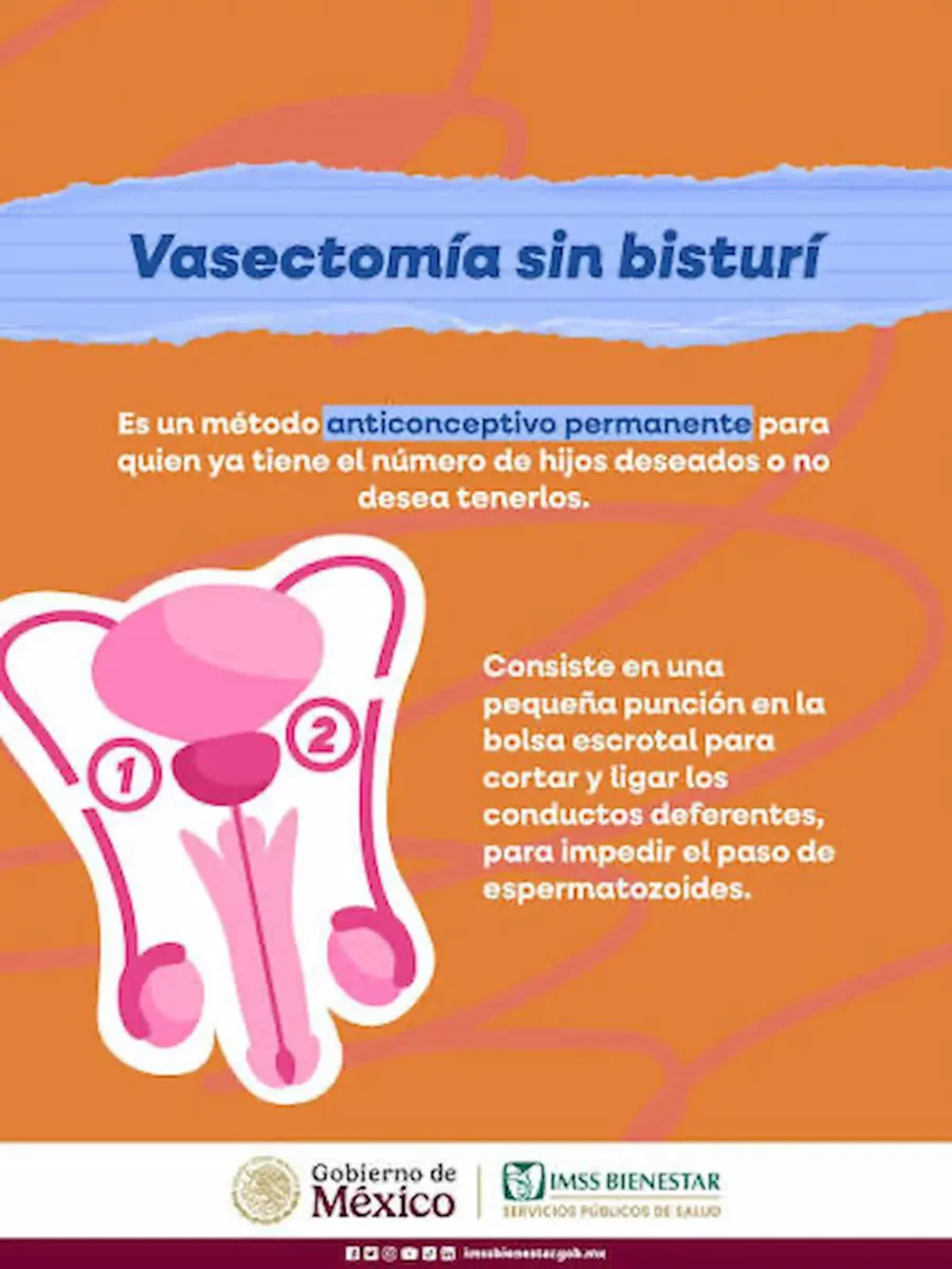 ¿Dónde hacen la vasectomía sin bisturí gratis en Puebla? Estos son los lugares 2 Dónde hacen la vasectomía sin bisturí gratis en Puebla