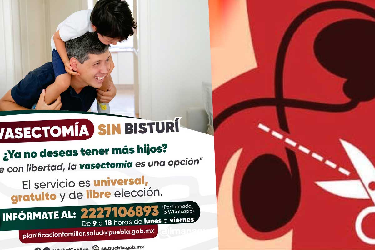 ¿Dónde hacen la vasectomía sin bisturí gratis en Puebla? Estos son los lugares