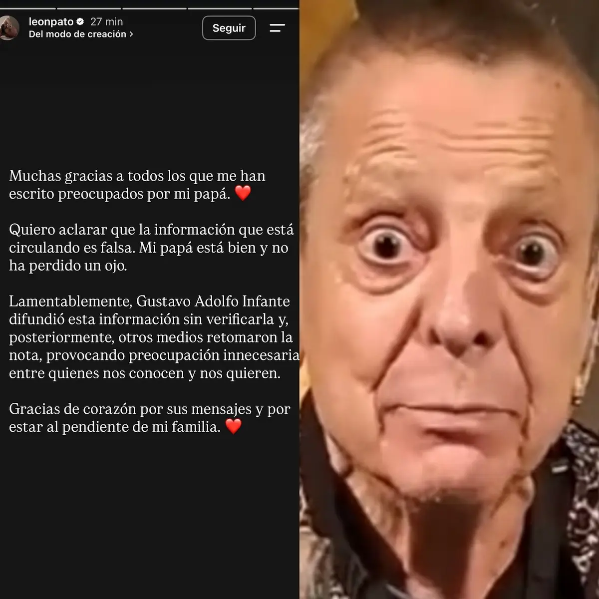 Desmienten que César Bono perdió un ojo