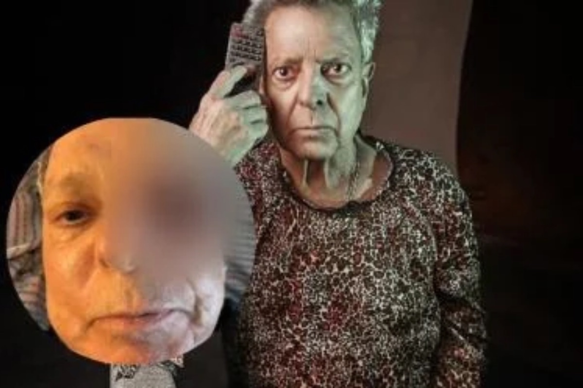 ¿César Bono perdió un ojo? Su hijo desmiente rumores sobre su salud 16 César Bono perdió un ojo